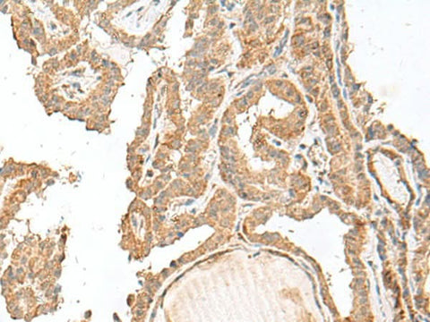 Anti-Human/Mouse GART Antibody - ABMIUM