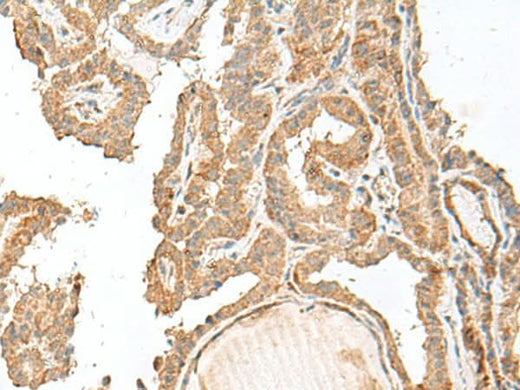 Anti-Human/Mouse GART Antibody - ABMIUM