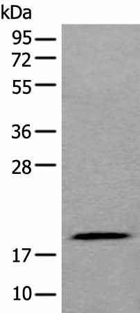 Anti-Human/Mouse ZNHIT1 Antibody