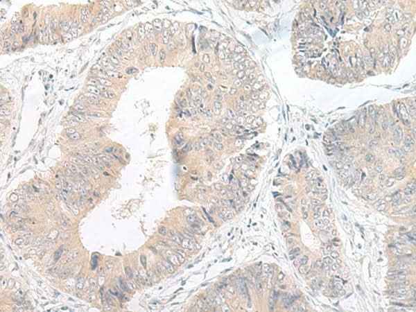Anti-Human/Mouse/Rat LYRM2 Antibody