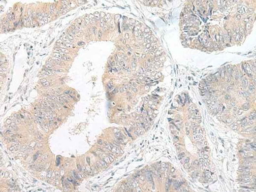 Anti-Human/Mouse/Rat LYRM2 Antibody