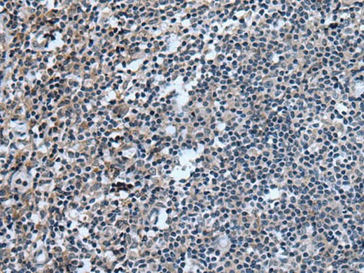 Immunohistochemistry of paraffin-embedded Human tonsil tissue using UGT8 Polyclonal Antibody at dilution of 1:55(×200)
