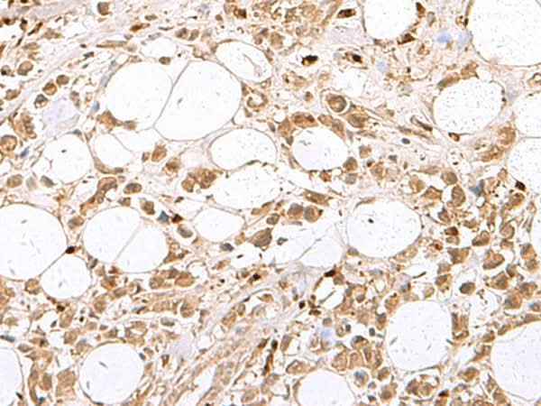 Anti-Human/Mouse/Rat RBFOX2 Antibody