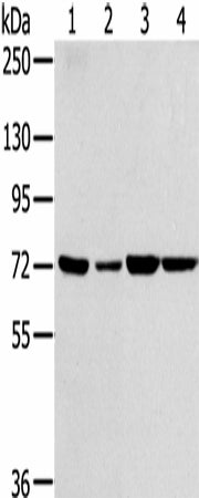 Anti-Human/Mouse SNX2 Antibody - ABMIUM