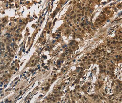 Anti-Human/Mouse CCAR1 Antibody