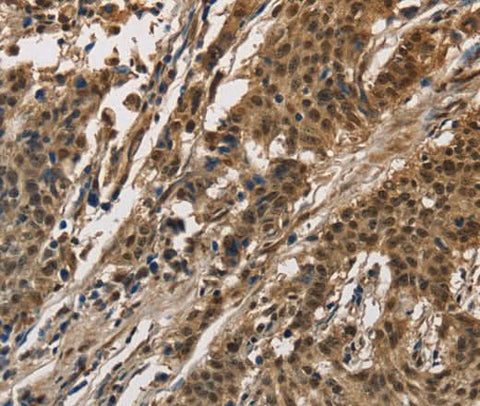 Anti-Human/Mouse CCAR1 Antibody - ABMIUM
