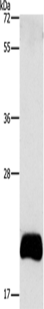 Anti-Human APOBEC3C Antibody - ABMIUM