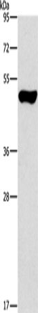 Anti-Human/Mouse/Rat ILK Antibody - ABMIUM