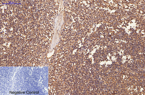 Immunohistochemistry of paraffin-embedded Human tonsil tissue using CD1A Monoclonal Antibody at dilution of 1:200.