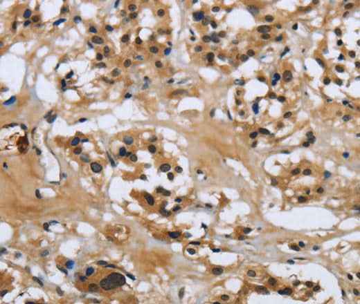 Anti-Human LGALS7 Antibody
