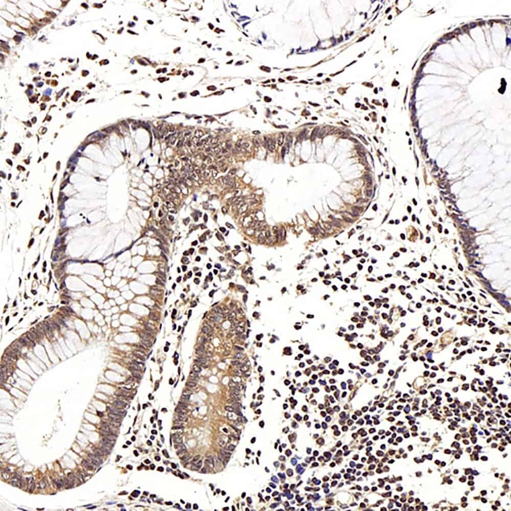 Immunohistochemistry analysis of paraffin-embedded human colon using LEP Polyclonal Antibody at dilution of 1:100.