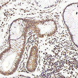 Immunohistochemistry analysis of paraffin-embedded human colon using LEP Polyclonal Antibody at dilution of 1:100.