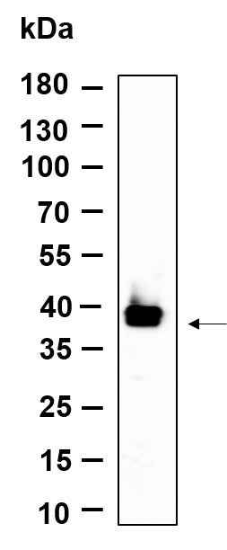 Anti-Human/Mouse/Rat dbx2 Antibody [B970] - ABMIUM
