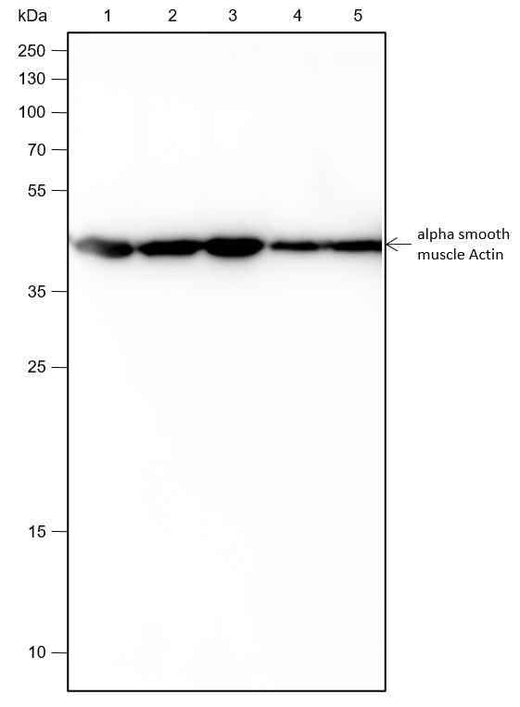 Anti-Human/Rat/Mouse alpha smooth muscle Actin Antibody [A130] - ABMIUM
