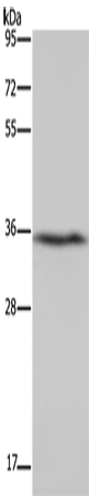 Anti-Human/Mouse/Rat DDAH1 Antibody - ABMIUM