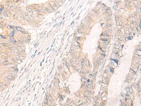 Anti-Human IL33 Antibody