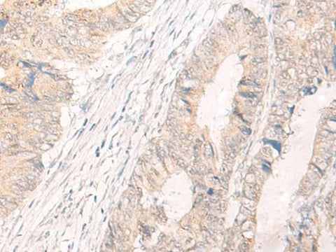Anti-Human IL33 Antibody - ABMIUM