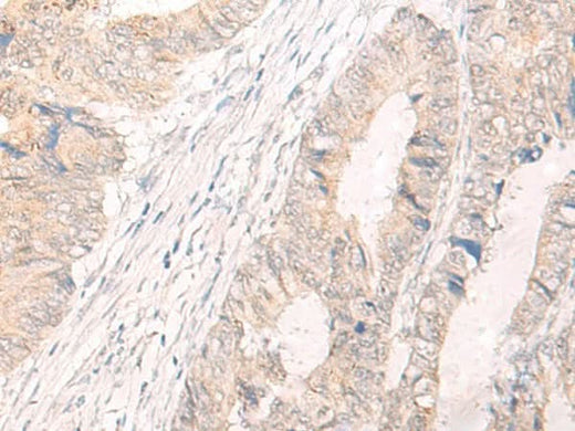 Anti-Human IL33 Antibody - ABMIUM
