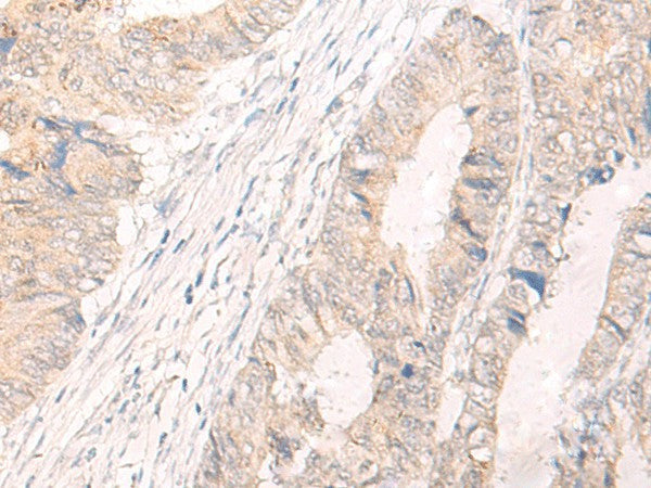 Anti-Human IL33 Antibody - ABMIUM