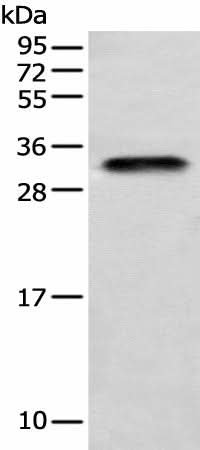 Western blot analysis of Human testis tissue using LYPD4 Polyclonal Antibody at dilution of 1:400