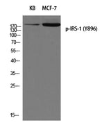 Western Blot analysis of 1) KB, 2) MCF7 cells using Phospho-IRS1 (Tyr896) Polyclonal Antibody at dilution of 1:500