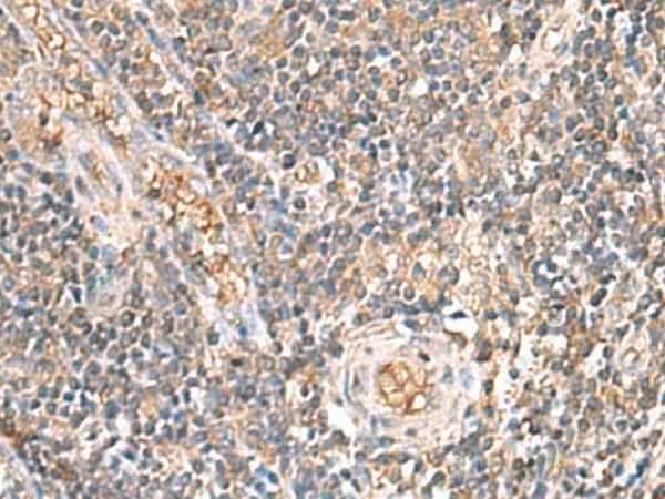 Anti-Human/Mouse/Rat ARF5 Antibody