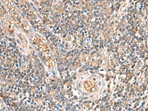 Anti-Human/Mouse/Rat ARF5 Antibody