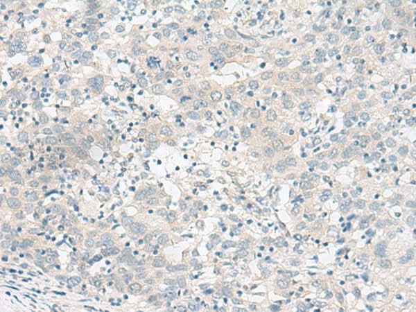 Anti-Human/Mouse/Rat RALGAPA1 Antibody