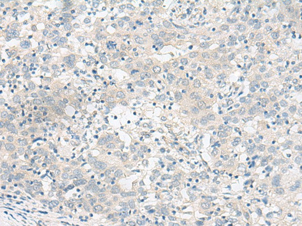 Anti-Human/Mouse/Rat RALGAPA1 Antibody - ABMIUM