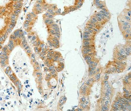 Anti-Human/Mouse SELM Antibody