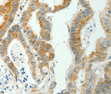 Anti-Human/Mouse SELM Antibody - ABMIUM