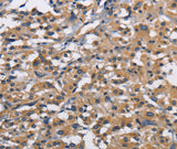 Anti-Human/Mouse/Rat CBY1 Antibody - ABMIUM