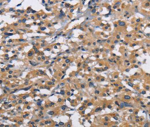Anti-Human/Mouse/Rat CBY1 Antibody