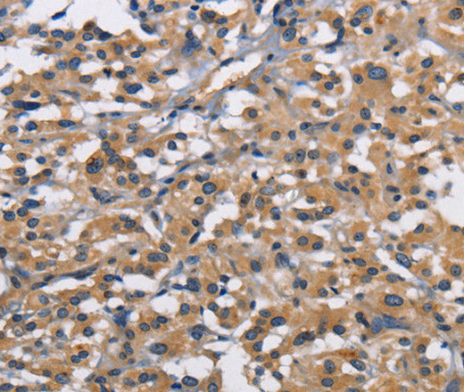 Anti-Human/Mouse/Rat CBY1 Antibody - ABMIUM