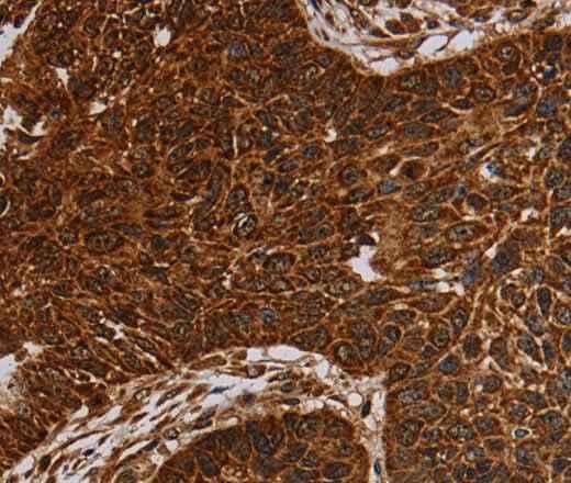 Anti-Human/Mouse NDUFAB1 Antibody