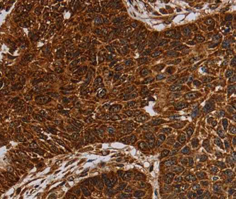 Anti-Human/Mouse NDUFAB1 Antibody