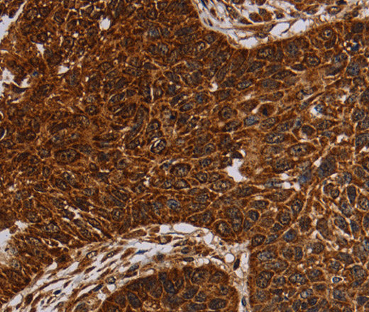 Anti-Human/Mouse NDUFAB1 Antibody - ABMIUM
