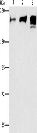 Anti-Human/Mouse/Rat ACE Antibody - ABMIUM