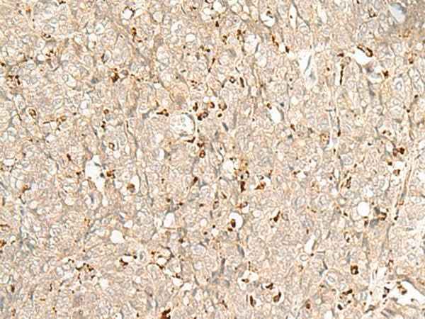 Anti-Human/Mouse/Rat NUP210 Antibody