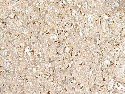 Anti-Human/Mouse/Rat NUP210 Antibody