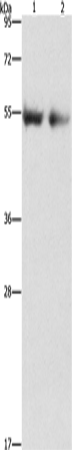 Anti-Human ANGPT4 Antibody - ABMIUM