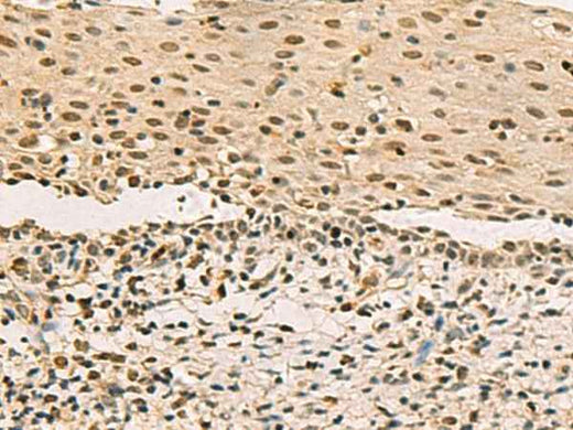 Anti-Human LRIF1 Antibody