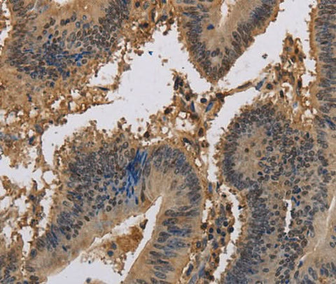 Anti-Human/Mouse KCNA7 Antibody - ABMIUM