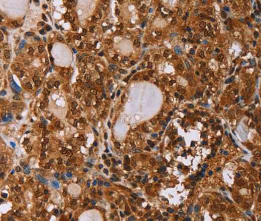 Anti-Human/Mouse IHH Antibody