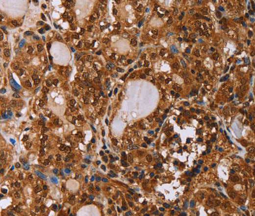 Anti-Human/Mouse IHH Antibody - ABMIUM