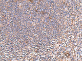 Immunohistochemistry of paraffin-embedded Human tonsil tissue using PDRG1 Polyclonal Antibody at dilution of 1:80(×200)
