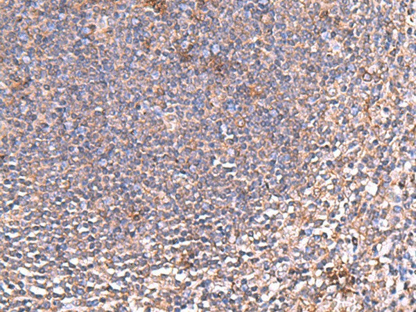 Immunohistochemistry of paraffin-embedded Human tonsil tissue using PDRG1 Polyclonal Antibody at dilution of 1:80(×200)