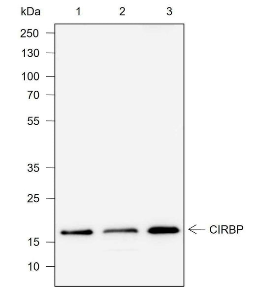 Anti-Human CIRBP Antibody [A731] - ABMIUM