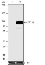 Anti-Human CPT1B Antibody [A672]