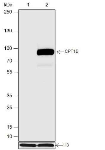 Anti-Human CPT1B Antibody [A672] - ABMIUM